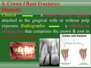 4- Crown I Root Fractures:
Diagnosis:
Clinical a mobile coronal segment
attached to the gingival with or without pulp
exposure. Radiographic a radiolucent
oblique line that comprises the crown & root in
a vertical direction.
 
