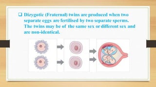  Dizygotic (Fraternal) twins are produced when two
separate eggs are fertilised by two separate sperms.
The twins may be of the same sex or different sex and
are non-identical.
 