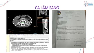 CA LÂM SÀNG
 
