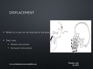 •
•
•
•
Monday, July
10, 2023
www.orthodonticcourseindelhi.com
 