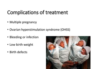 Complications of treatment
• Multiple pregnancy
• Ovarian hyperstimulation syndrome (OHSS)
• Bleeding or infection
• Low birth weight
• Birth defects
 