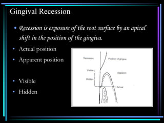Gingival Recession
• Recession is exposure of the root surface by an apical
shift in the position of the gingiva.
• Actual position
• Apparent position
• Visible
• Hidden
 