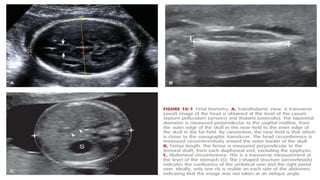 Interocular Distance Radiology 2. Fetal Imaging.pptx