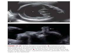 Interocular Distance Radiology 2. Fetal Imaging.pptx