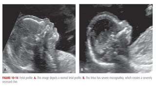 2. Fetal Imaging.pptx