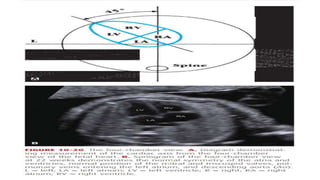 Interocular Distance Radiology 2. Fetal Imaging.pptx
