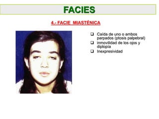  Caída de uno o ambos
parpados (ptosis palpebral)
 inmovilidad de los ojos y
diplopía
 Inexpresividad
FACIES
4.- FACIE MIASTÉNICA
 