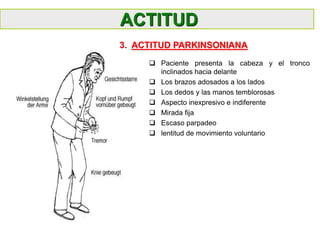 ACTITUD
 Paciente presenta la cabeza y el tronco
inclinados hacia delante
 Los brazos adosados a los lados
 Los dedos y las manos temblorosas
 Aspecto inexpresivo e indiferente
 Mirada fija
 Escaso parpadeo
 lentitud de movimiento voluntario
3. ACTITUD PARKINSONIANA
 