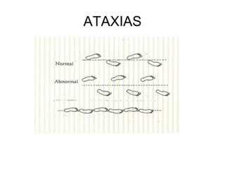 ATAXIAS
 