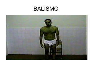 BALISMO
 