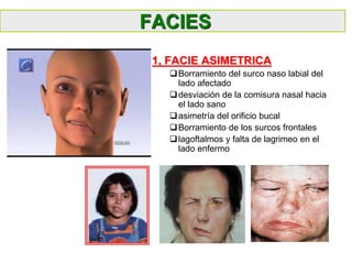 FACIES
1, FACIE ASIMETRICA
Borramiento del surco naso labial del
lado afectado
desviación de la comisura nasal hacia
el lado sano
asimetría del orificio bucal
Borramiento de los surcos frontales
lagoftalmos y falta de lagrimeo en el
lado enfermo
 