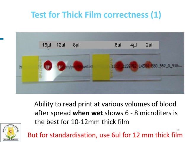 2. Preparation and staining of thick and thin blood films.ppt