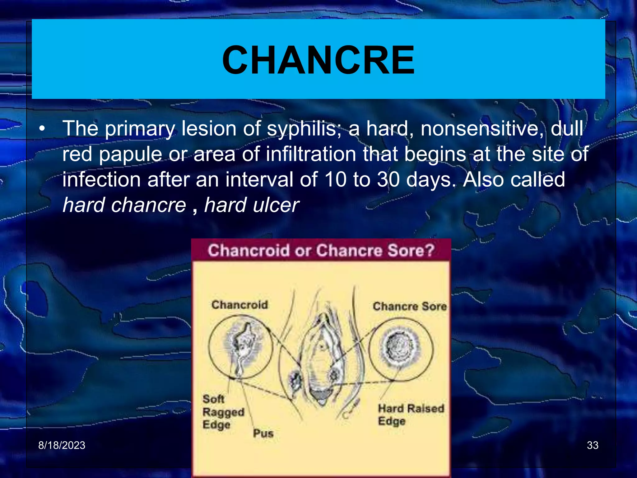 SEXUAL TRANSMITED DISEASE (STD).ppt