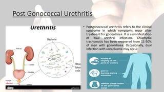 Post Gonococcal Urethritis
• Postgonococcal urethritis refers to the clinical
syndrome in which symptoms recur after
treatment for gonorrhoea. It is a manifestation
of dual urethral infection. Chlamydia
trachomatis has been recovered from 11-50%
of men with gonorrhoea. Occasionally, dual
infection with ureaplasma may occur.
 