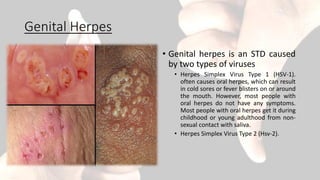 Genital Herpes
• Genital herpes is an STD caused
by two types of viruses
• Herpes Simplex Virus Type 1 (HSV-1).
often causes oral herpes, which can result
in cold sores or fever blisters on or around
the mouth. However, most people with
oral herpes do not have any symptoms.
Most people with oral herpes get it during
childhood or young adulthood from non-
sexual contact with saliva.
• Herpes Simplex Virus Type 2 (Hsv-2).
 