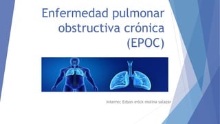 Enfermedad pulmonar
obstructiva crónica
(EPOC)
Interno: Edson erick molina salazar
 
