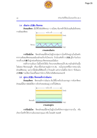 ตํารับยาจีนที่ใชบอยในประเทศไทย เลม 2
12
ชีพจรจมลึก
หายใจ 1 ครั้ง
กระดูก
ผิวหนัง
3.4 เฉินมาย (沉脉): ชีพจรจม
ลักษณะชีพจร: เมื่อใชนิ้วสัมผัสชีพจรเบา ๆ จะไมพบ ตองกดลึกใตบริเวณเสนเอ็นจึงจะพบ
การเตนของชีพจร
ภาพแสดงเฉินมาย
การวินิจฉัยโรค: ชีพจรลักษณะนี้มักพบในผูปวยกลุมอาการโรคที่เกิดอยูภายในเปนหลัก
หากการเตนของชีพจรจมและมีแรงมักจะเกี่ยวกับโรคแกรง ถาอวัยวะตันทั้ง 5 (五脏 อูจั้ง) กับอวัยวะ
กลวงทั้ง 6 (六腑 ลิ่วฝู) พรองหรือออนแอ ชีพจรจะจมและไมมีแรง
คนที่รางกายแข็งแรง ไมมีโรคภัยไขเจ็บ ก็สามารถพบชีพจรจมได เชน คนอวนมีกลามเนื้อ
ไขมันหนา ชีพจรจะอยูลึก หรืออาจขึ้นกับสภาพภูมิอากาศ เชน คนในประเทศที่มีอากาศหนาวเย็น
มักจะมีชีพจรจม นอกจากนี้ยังมีคนที่มีชีพจรทั้ง 2 ขางจมเล็ก แตรางกายไมมีโรค เรียกวา “ลิ่วอินมาย
(六阴脉)” พบไดมากในคนที่ไมออกกําลังกาย ซึ่งถือวาเปนชีพจรของคนปกติ
3.5 ฝูมาย (伏脉): ชีพจรจมลึกกวาเฉินมาย
ลักษณะชีพจร: ชีพจรจมลึกกวาเฉินมาย ตองใชนิ้วกดถึงบริเวณกระดูก การจับหาชีพจร
ลักษณะนี้เปนการสัมผัสไดยาก คลายกับหลบซอนอยู บางครั้งไมชัดเจน
ภาพแสดงฝูมาย
การวินิจฉัยโรค: ชีพจรลักษณะนี้มักพบในผูปวยโรคที่เกิดจากกลุมอาการภายใน หรือ
เกิดจากโรคที่ทําใหรางกายเจ็บปวดอยางรุนแรง หรือ โรคลมชัก หมดสติ
ชีพจรจม
กระดูก
ผิวหนัง
หายใจ 1 ครั้ง
Page 35
 