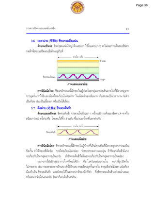 การตรวจชีพจรของแพทยแผนจีน 13
กระดูก
ผิวหนัง
3.6 เหลามาย (牢脉): ชีพจรจมตึงแนน
ลักษณะชีพจร: ชีพจรจมแนนใหญ ตึงและยาว ใชนิ้วแตะเบา ๆ จะไมเจอการเตนของชีพจร
กดลึกจึงจะเจอชีพจรแข็งดานอยูกับที่
ภาพแสดงเหลามาย
การวินิจฉัยโรค: ชีพจรลักษณะนี้มักพบในผูปวยโรคกลุมอาการเย็นภายในที่มีสาเหตุจาก
การอุดกั้น ทําใหชี่และเลือดไหลเวียนไมสะดวก ในเลือดมีของเสียมาก เก็บสะสมเปนเวลานาน กอตัว
เปนกอน เชน เปนเนื้องอก หรือเปนไสเลื่อน
3.7 ฉือมาย (迟脉): ชีพจรเตนชา
ลักษณะของชีพจร: ชีพจรเตนชา การหายใจเขาออก 1 ครั้งจะมีการเตนของชีพจร 3~4 ครั้ง
(นอยกวา 60 ครั้ง/นาที) โดยพบไดทั้ง 3 ระดับ ซึ่งบงบอกโรคที่แตกตางกัน
ภาพแสดงฉือมาย
การวินิจฉัยโรค: ชีพจรลักษณะนี้มักพบในผูปวยที่เปนโรคเย็นที่มีสาเหตุจากความเย็น
ปดกั้น ทําใหหยางชี่ติดขัด การไหลเวียนไมคลอง รางกายขาดความอบอุน ถาชีพจรเตนชามีแรง
จะเกี่ยวกับโรคกลุมอาการเย็นแกรง ถาชีพจรเตนชาไมมีแรงจะเกี่ยวกับโรคกลุมอาการเย็นพรอง
นอกจากนี้ยังมีกลุมอาการโรคที่พบไดอีก คือ โรครอนซอนภายใน หยางชี่ถูกปดกั้น
ไมกระจาย เชน กระเพาะอาหารอักเสบ ลําไสอักเสบ ความรอนอุดกั้นภายใน ธาตุแข็งถายไมออก แนนทอง
มือเทาเย็น ชีพจรเตนชา และยังพบไดในภาวะปกติของนักกีฬา ซึ่งชีพจรจะเตนชาอยางสม่ําเสมอ
หรือคนปกติเมื่อนอนหลับ ชีพจรก็จะเตนชาเชนกัน
ชีพจรจมตึงแนน
หายใจ 1 ครั้ง
ชีพจรเตนชา
หายใจ 1 ครั้ง
Page 36
 