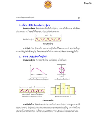 การตรวจชีพจรของแพทยแผนจีน 15
2 มม.
ชุน กวน ฉื่อ
3.10 จี๋มาย (疾脉): ชีพจรเตนเร็วกวาสูมาย
ลักษณะของชีพจร: ชีพจรลักษณะนี้จะเตนเร็วกวาสูมาย การหายใจเขาออก 1 ครั้ง ชีพจร
เตนมากกวา 7 ครั้ง โดยพบไดทั้ง 3 ระดับ ซึ่งบงบอกโรคที่แตกตางกัน
ภาพแสดงจี๋มาย
การวินิจฉัย: ชีพจรลักษณะนี้สวนมากพบในผูปวยโรคที่เกิดจากหยางแกรง ความรอนขึ้นสูง
มาก ทําใหสูญเสียอินชี่ (ธาตุน้ํา) ถาชีพจรพรองออนไมมีแรง แสดงวาหยางชี่ของรางกายจะสูญสิ้นไป
3.11 หงมาย (洪脉): ชีพจรใหญมีพลัง
ลักษณะของชีพจร: ชีพจรลอยกวางใหญ มาแรงไปออน มาใหญไปยาว
การเตนของชีพจรขึ้นและลงทั้งสูงใหญและยาว ความกวางของชีพจรใหญกวาปกติ
ภาพแสดงหงมาย
การวินิจฉัยโรค: ชีพจรลักษณะนี้สวนมากเกี่ยวกับความรอนในรางกายสูงมาก ทําให
หลอดเลือดขยาย ถาผูปวยเปนโรคเรื้อรังและพบลักษณะการเตนของชีพจรลอยใหญ แสดงวาโรคนั้นจะ
เปนหนักขึ้นในกรณีที่อากาศรอน คนที่รางกายแข็งแรงปกติอาจตรวจพบชีพจรลอยใหญและเตนสม่ําเสมอ
จังหวะการเตนขึ้น ชีพจรจะแรงใหญมีพลังมาก
จังหวะการเตนลง ชีพจรจะออนเบาเล็กนอย
ชีพจรเตนเร็วกวาสูมาย
หายใจ 1 ครั้ง
หายใจ 1 ครั้ง
ชีพจรเตนเลยตําแหนงชุน กวน ฉื่อ
Page 38
 
