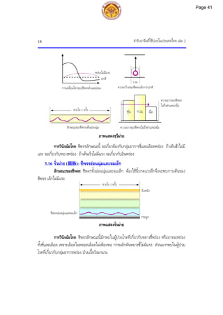 ตํารับยาจีนที่ใชบอยในประเทศไทย เลม 2
18
ชีพจรออนนุมและจมเล็ก
หายใจ 1 ครั้ง
กระดูก
ผิวหนัง
ความยาวของชีพจร
ไมถึงตําแหนงฉื่อ
ชุน กวน ฉื่อ
ความยาวของชีพจรไมถึงตําแหนงฉื่อ
ภาพแสดงซฺวีมาย
การวินิจฉัยโรค: ชีพจรลักษณะนี้ จะเกี่ยวของกับกลุมอาการชี่และเลือดพรอง ถาเตนชาไมมี
แรง จะเกี่ยวกับหยางพรอง ถาเตนเร็วไมมีแรง จะเกี่ยวกับอินพรอง
3.16 รั่วมาย (弱脉): ชีพจรออนนุมและจมเล็ก
ลักษณะของชีพจร: ชีพจรทั้งออนนุมและจมเล็ก ตองใชนิ้วกดแรงลึกจึงจะพบการเตนของ
ชีพจร เล็กไมมีแรง
ภาพแสดงรั่วมาย
การวินิจฉัยโรค: ชีพจรลักษณะนี้มักพบในผูปวยโรคที่เกี่ยวกับหยางชี่พรอง หรืออาจจะพรอง
ทั้งชี่และเลือด เพราะเลือดในหลอดเลือดไมเพียงพอ การผลักดันหยางชี่ไมมีแรง สวนมากพบในผูปวย
โรคที่เกี่ยวกับกลุมอาการพรอง ปวยเรื้อรังมานาน
ปกติ
พรองไมมีแรง
การเคลื่อนไหวของชีพจรต่ําและออน
2 มม.
ความกวางของชีพจรเล็กกวาปกติ
หายใจ 1 ครั้ง
ลักษณะของชีพจรเตนออนนุม
Page 41
 
