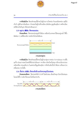ตํารับยาจีนที่ใชบอยในประเทศไทย เลม 2
24
การวินิจฉัยโรค: ชีพจรลักษณะนี้มักพบในผูปวยภาวะไตพรอง จิงและเลือดพรอง อสุจิไม
เก็บกัก ภูมิตานทานไมแข็งแรง มักจะพบในผูปวยที่ขาดเลือด เสียเลือด สูญเสียอสุจิมาก สตรีตกเลือด
สตรีมีครรภแทงบุตร หรือประจําเดือนมามาก
3.25 หรูมาย (濡脉): ชีพจรลอยออน
ลักษณะชีพจร: ชีพจรลอยออนนุมเล็กไมมีแรง เหมือนกับเกสรดอกไมลอยอยูบนน้ํา ใชนิ้ว
สัมผัสเบา ๆ จะมีชีพจรเตน กดหนักเกินไปจะไมชัดเจน
ภาพแสดงหรูมาย
การวินิจฉัยโรค: ชีพจรลักษณะนี้มักพบในผูปวยกลุมอาการพรอง รางกายออนแอ ความชื้น
อุดกั้น สวนมากจะพบในสตรีที่มีประจําเดือนมาก ตกเลือด เลือดไหลไมหยุด หรือกะปริดกะปรอย
เหน็ดเหนื่อย ออนเพลียงาย ในเพศชายที่สูญเสียอสุจิมาก หรือทองเสียเรื้อรัง ชี่พรอง เหงื่อออกงาย
เหนื่อยหอบ หายใจสั้น
3.26 เจี๋ยมาย (结脉): ชีพจรเตนชาและจังหวะหยุดไมแนนอน
ลักษณะของชีพจร: ชีพจรจะเตนชากวาปกติ ไมสม่ําเสมอ เตนแลวหยุด จังหวะไมแนนอน
โดยพบไดทั้ง 3 ระดับ ซึ่งบงบอกโรคที่แตกตางกัน
ภาพแสดงเจี๋ยมาย
หายใจ 1 ครั้ง
กระดูก
ผิวหนัง
ชีพจรลอยออนนุมเล็กไมมีแรง
ชีพจรเตนชา
จังหวะหยุดไมแนนอน
หายใจ 1 ครั้ง หายใจ 1 ครั้ง
Page 47
 
