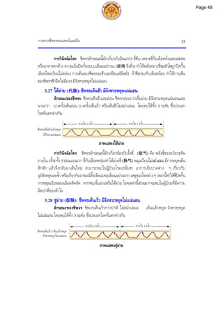 การตรวจชีพจรของแพทยแผนจีน 25
การวินิจฉัยโรค: ชีพจรลักษณะนี้มักเกี่ยวกับอินแกรง ชี่ตีบ เพราะชี่กับเลือดคั่งและเสมหะ
หรืออาหารตกคาง ความเย็นปดกั้นระบบเสนลมปราณ (经络 จิงลั่ว) ทําใหพลังหยางชี่ของหัวใจถูกปดกั้น
เลือดไหลเวียนไมคลอง การเตนของชีพจรจะชาและฝดแตมีพลัง ถาชี่พรองกับเลือดนอย ทําใหการเตน
ของชีพจรชาฝดไมมีแรง มีจังหวะหยุดไมแนนอน
3.27 ใตมาย (代脉): ชีพจรเตนชา มีจังหวะหยุดแนนอน
ลักษณะของชีพจร: ชีพจรเตนชาและออน ชีพจรออนกวาเจี๋ยมาย มีจังหวะหยุดแนนอนและ
นานกวา บางครั้งเตนออน บางครั้งเตนเร็ว หรือเตนชาไมสม่ําเสมอ โดยพบไดทั้ง 3 ระดับ ซึ่งบงบอก
โรคที่แตกตางกัน
ภาพแสดงใตมาย
การวินิจฉัยโรค: ชีพจรลักษณะนี้มักเกี่ยวของกับจั้งชี่ (脏气) คือ พลังชี่ของอวัยวะตัน
ภายใน (จั้ง) ทั้ง 5ออนแรงมาก ชี่กับเลือดพรองทําใหมายชี่ (脉气) หมุนเวียนไมสม่ําเสมอ มีการหยุดเตน
สักพัก แลวจึงกลับมาเตนใหม สามารถพบในผูปวยโรคเหน็บชา อาการเจ็บปวดตาง ๆ เกี่ยวกับ
อุบัติเหตุบอบช้ํา หรือเกี่ยวกับอารมณทั้งเจ็ดแปรเปลี่ยนอยางมาก เหตุของโรคตาง ๆ เหลานี้ทําใหชี่ปดกั้น
การหมุนเวียนของเลือดติดขัด หากพบเจี๋ยมายหรือใตมาย โรคเหลานี้สวนมากจะพบในผูปวยที่มีความ
ผิดปกติของหัวใจ
3.28 ชูมาย (促脉): ชีพจรเตนเร็ว มีจังหวะหยุดไมแนนอน
ลักษณะของชีพจร: ชีพจรเตนเร็วกวาปกติ ไมสม่ําเสมอ เตนแลวหยุด จังหวะหยุด
ไมแนนอน โดยพบไดทั้ง 3 ระดับ ซึ่งบงบอกโรคที่แตกตางกัน
ภาพแสดงชูมาย
ชีพจรเตนชาแลวหยุด
มีจังหวะแนนอน
หายใจ 1 ครั้ง หายใจ 1 ครั้ง
ชีพจรเตนเร็ว เตนแลวหยุด
จังหวะหยุดไมแนนอน
หายใจ 1 ครั้ง หายใจ 1 ครั้ง
Page 48
 