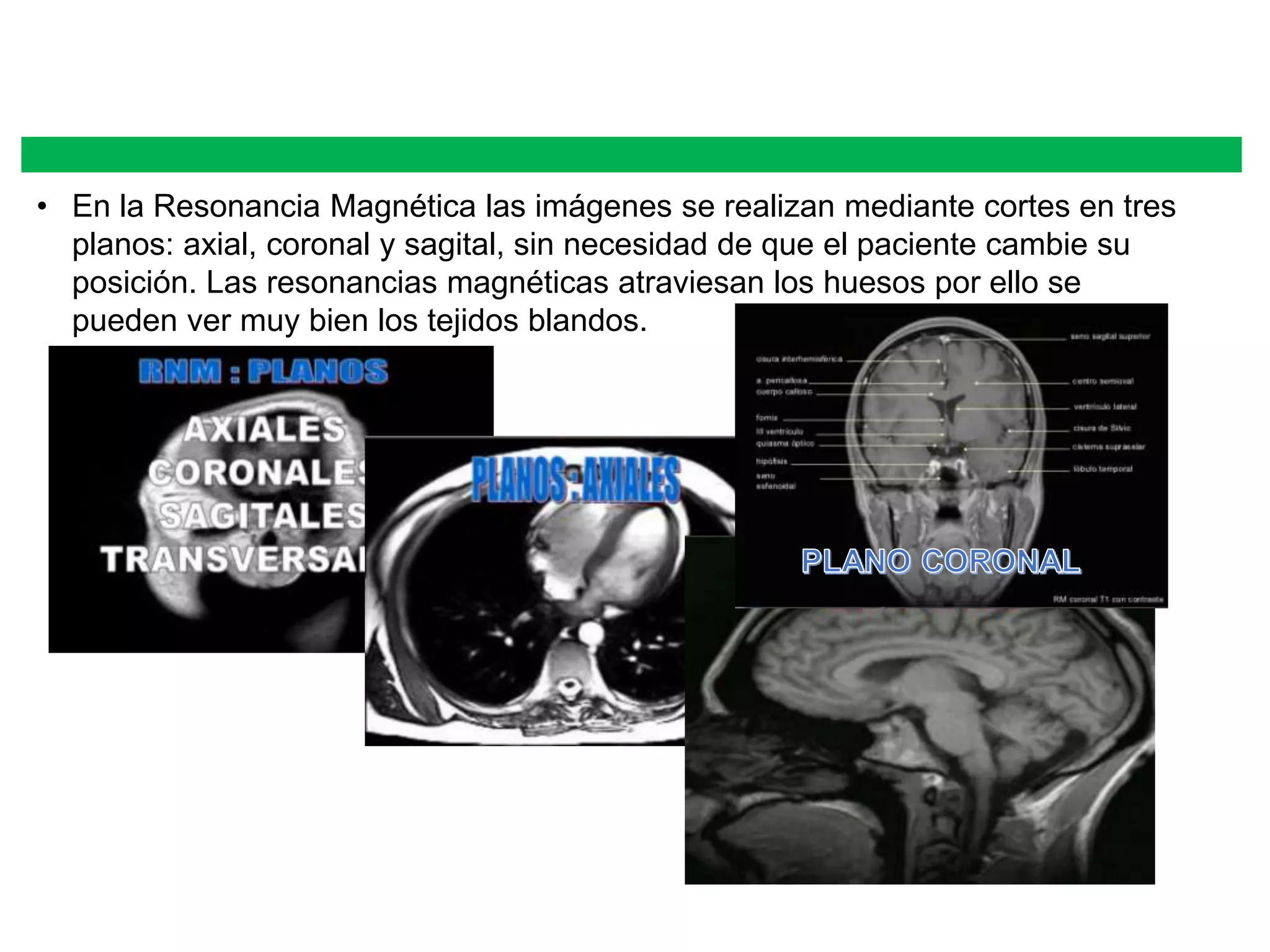 • En la Resonancia Magnética las imágenes se realizan mediante cortes en tres
planos: axial, coronal y sagital, sin necesidad de que el paciente cambie su
posición. Las resonancias magnéticas atraviesan los huesos por ello se
pueden ver muy bien los tejidos blandos.
 