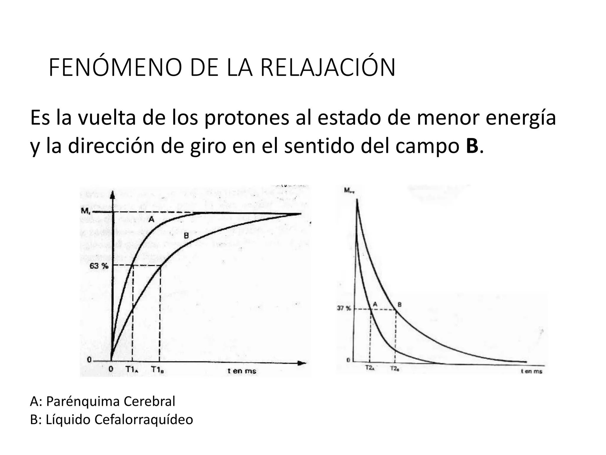 FENÓMENO DE LA RELAJACIÓN
Es la vuelta de los protones al estado de menor energía
y la dirección de giro en el sentido del campo B.
A: Parénquima Cerebral
B: Líquido Cefalorraquídeo
 