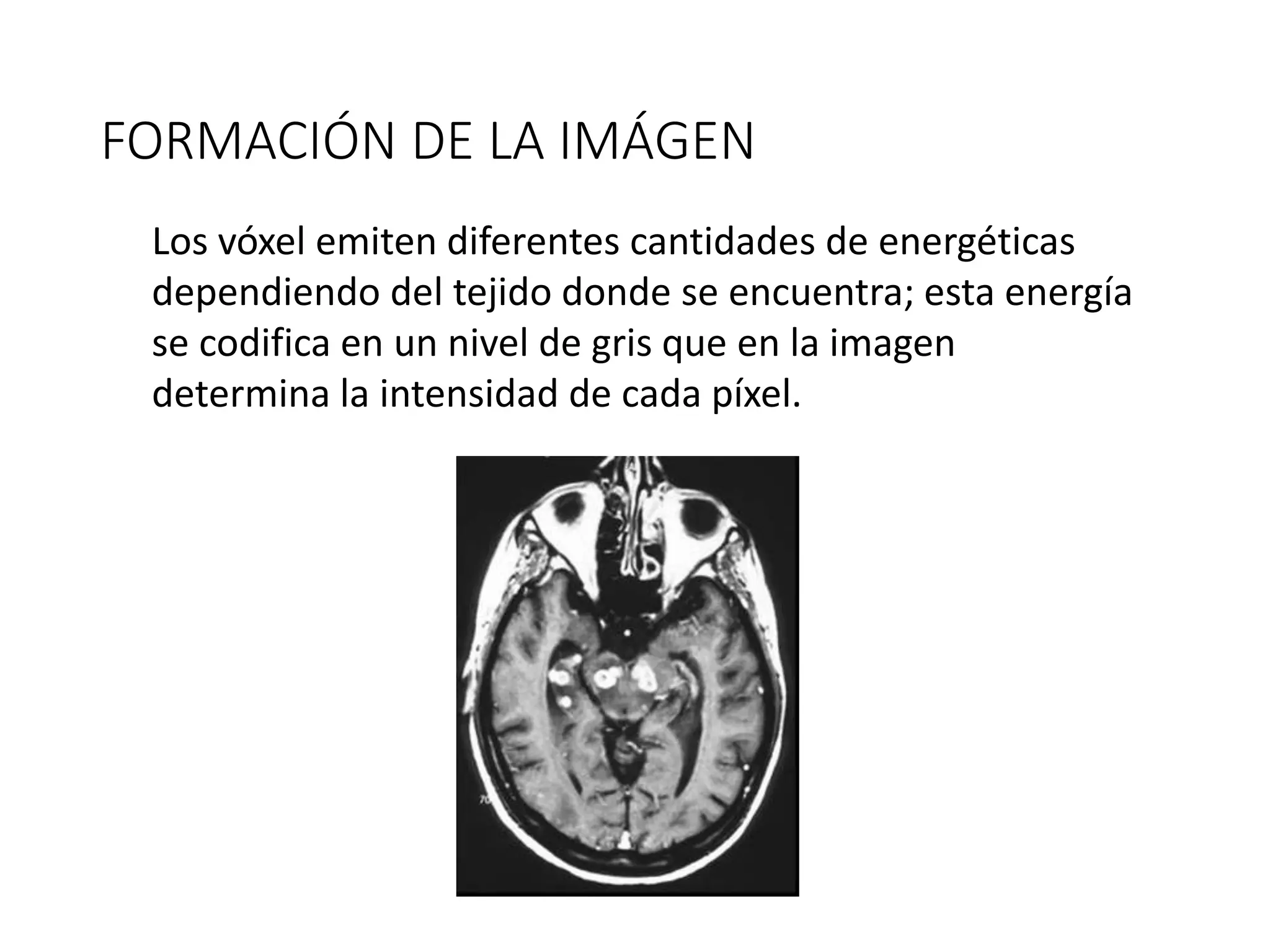 FORMACIÓN DE LA IMÁGEN
Los vóxel emiten diferentes cantidades de energéticas
dependiendo del tejido donde se encuentra; esta energía
se codifica en un nivel de gris que en la imagen
determina la intensidad de cada píxel.
 