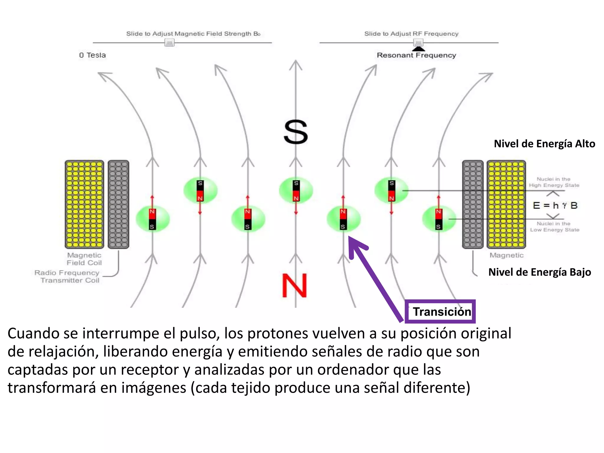 Cuando se interrumpe el pulso, los protones vuelven a su posición original
de relajación, liberando energía y emitiendo señales de radio que son
captadas por un receptor y analizadas por un ordenador que las
transformará en imágenes (cada tejido produce una señal diferente)
Nivel de Energía Alto
Nivel de Energía Bajo
Transición
 