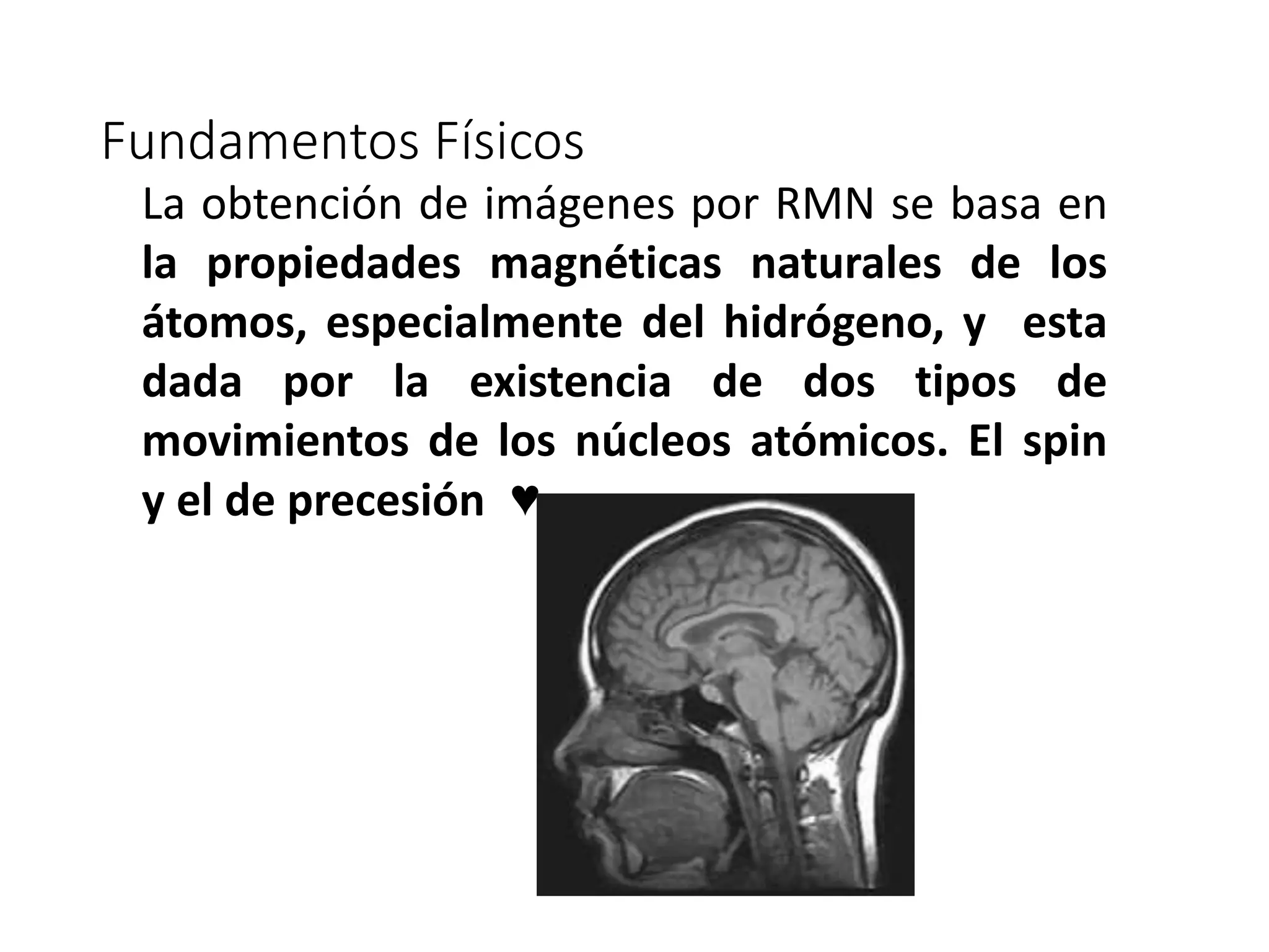Fundamentos Físicos
La obtención de imágenes por RMN se basa en
la propiedades magnéticas naturales de los
átomos, especialmente del hidrógeno, y esta
dada por la existencia de dos tipos de
movimientos de los núcleos atómicos. El spin
y el de precesión ♥
 