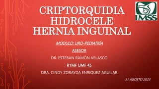 CRIPTORQUIDIA
HIDROCELE
HERNIA INGUINAL
MODULO: URO-PEDIATRÍA
ASESOR
DR. ESTEBAN RAMÓN VELASCO
R1MF UMF 45
DRA. CINDY ZORAYDA ENRIQUEZ AGUILAR
31 AGOSTO 2023
 