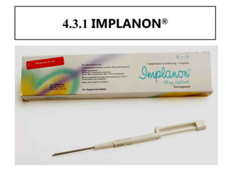 51
4.3.1 IMPLANON®
51
 