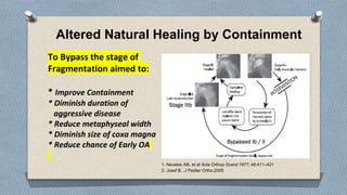 Containment Principles Principles of Containment in PERTHES AKU August 2023.pptx