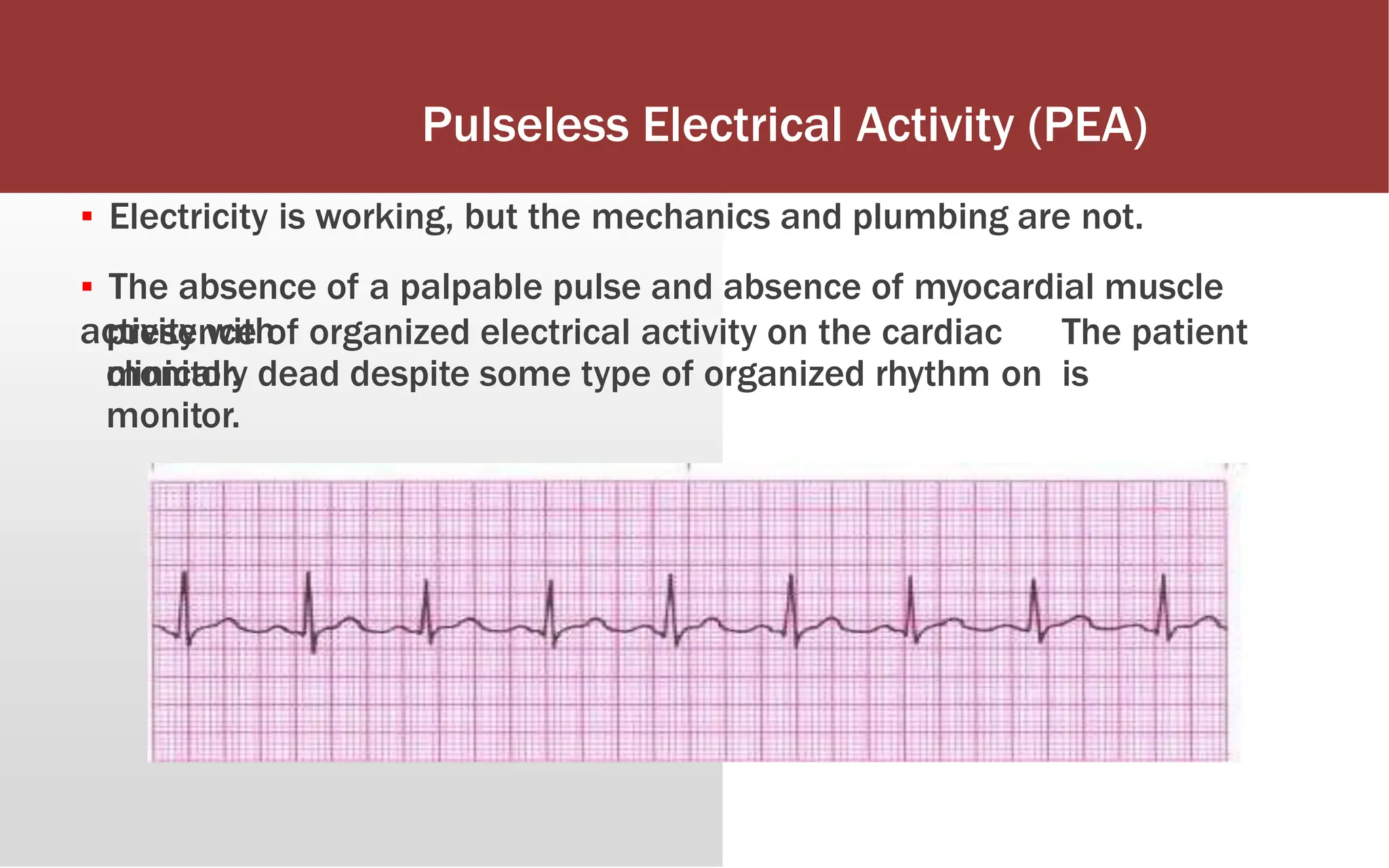 Pulseless Electrical Activity (PEA)
▪ Electricity is working, but the mechanics and plumbing are not.
▪ The absence of a palpable pulse and absence of myocardial muscle
activity with
presence of organized electrical activity on the cardiac
monitor.
The patient
is
clinically dead despite some type of organized rhythm on
monitor.
 