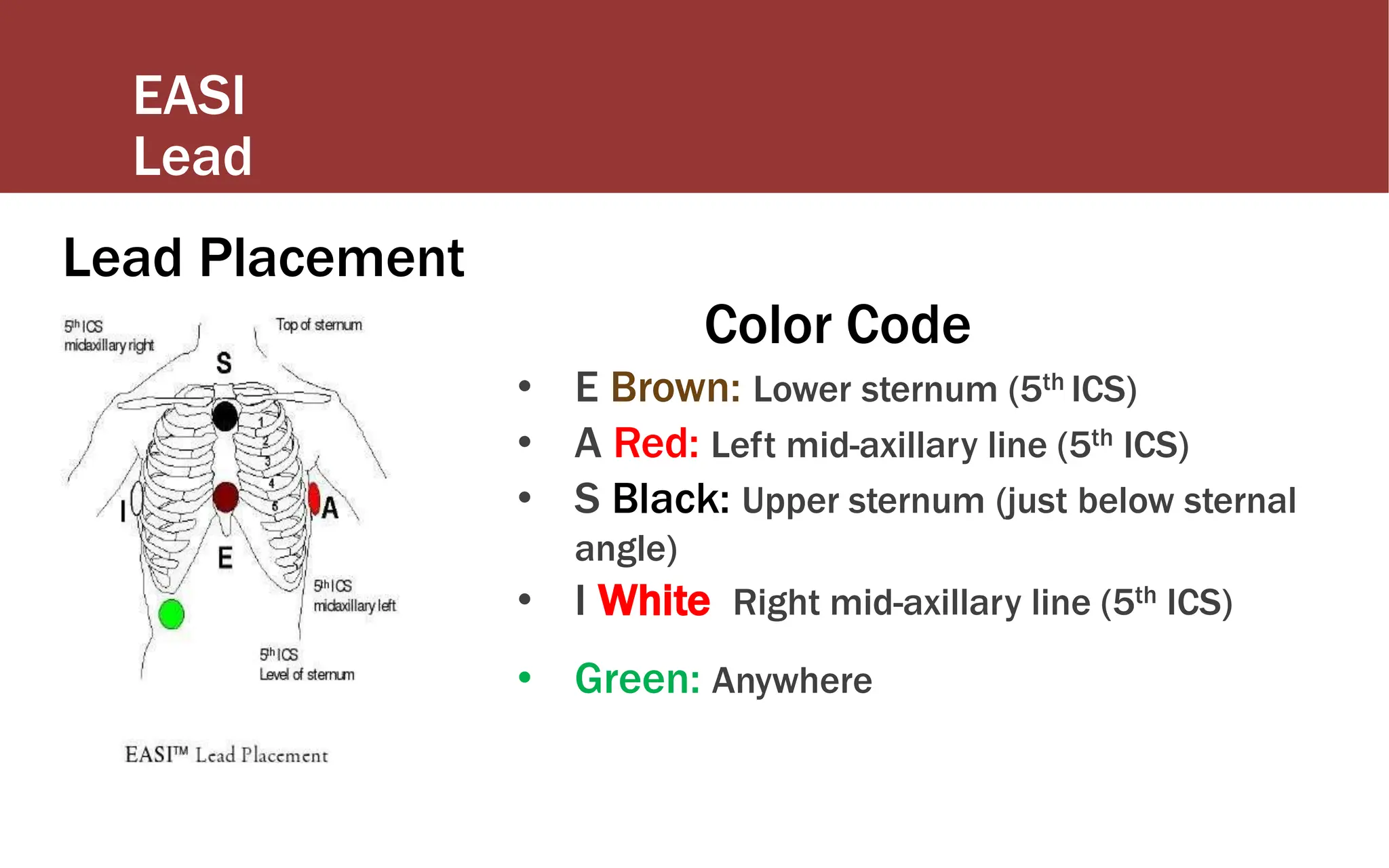EASI
Lead
Lead Placement
Color Code
• E Brown: Lower sternum (5th ICS)
• A Red: Left mid-axillary line (5th ICS)
• S Black: Upper sternum (just below sternal
angle)
• I White: Right mid-axillary line (5th ICS)
• Green: Anywhere
 
