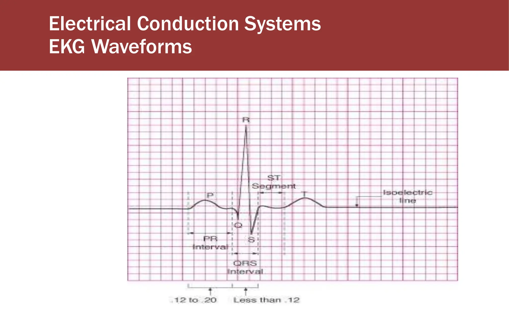 Electrical Conduction Systems
EKG Waveforms
 