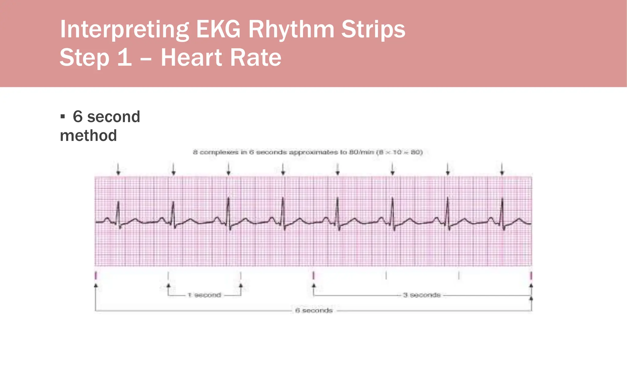 Interpreting EKG Rhythm Strips
Step 1 – Heart Rate
▪ 6 second
method
 