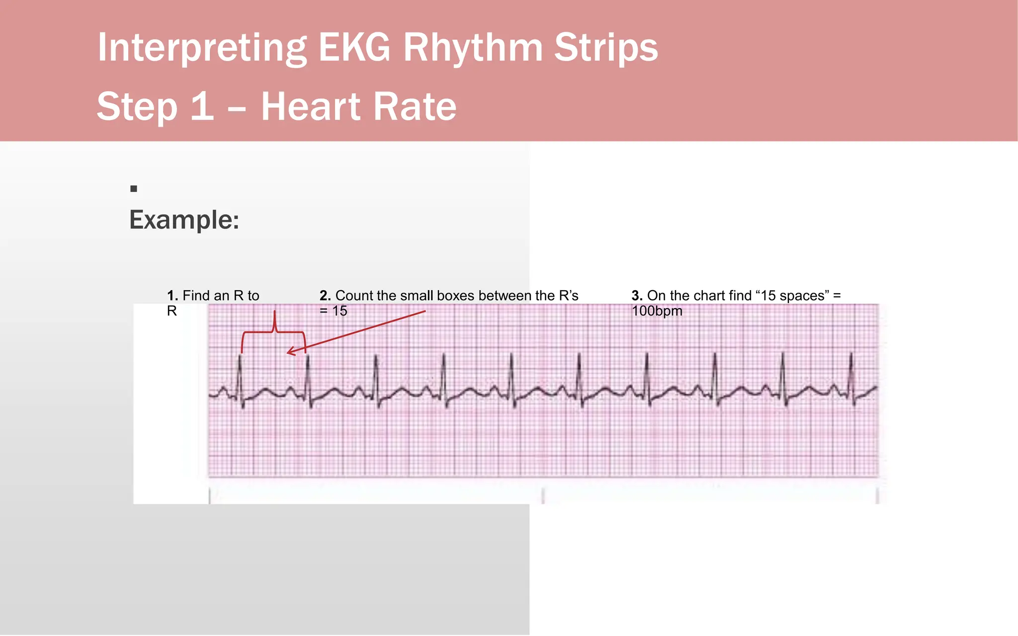 Interpreting EKG Rhythm Strips
Step 1 – Heart Rate
▪
Example:
1. Find an R to
R
2. Count the small boxes between the R’s
= 15
3. On the chart find “15 spaces” =
100bpm
 