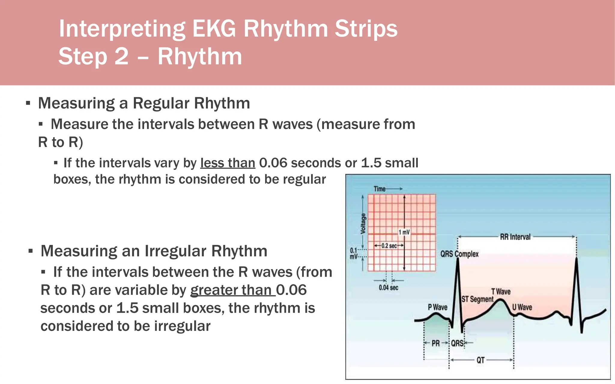 Interpreting EKG Rhythm Strips
Step 2 – Rhythm
▪ Measuring a Regular Rhythm
▪ Measure the intervals between R waves (measure from
R to R)
▪ If the intervals vary by less than 0.06 seconds or 1.5 small
boxes, the rhythm is considered to be regular
▪ Measuring an Irregular Rhythm
▪ If the intervals between the R waves (from
R to R) are variable by greater than 0.06
seconds or 1.5 small boxes, the rhythm is
considered to be irregular
 