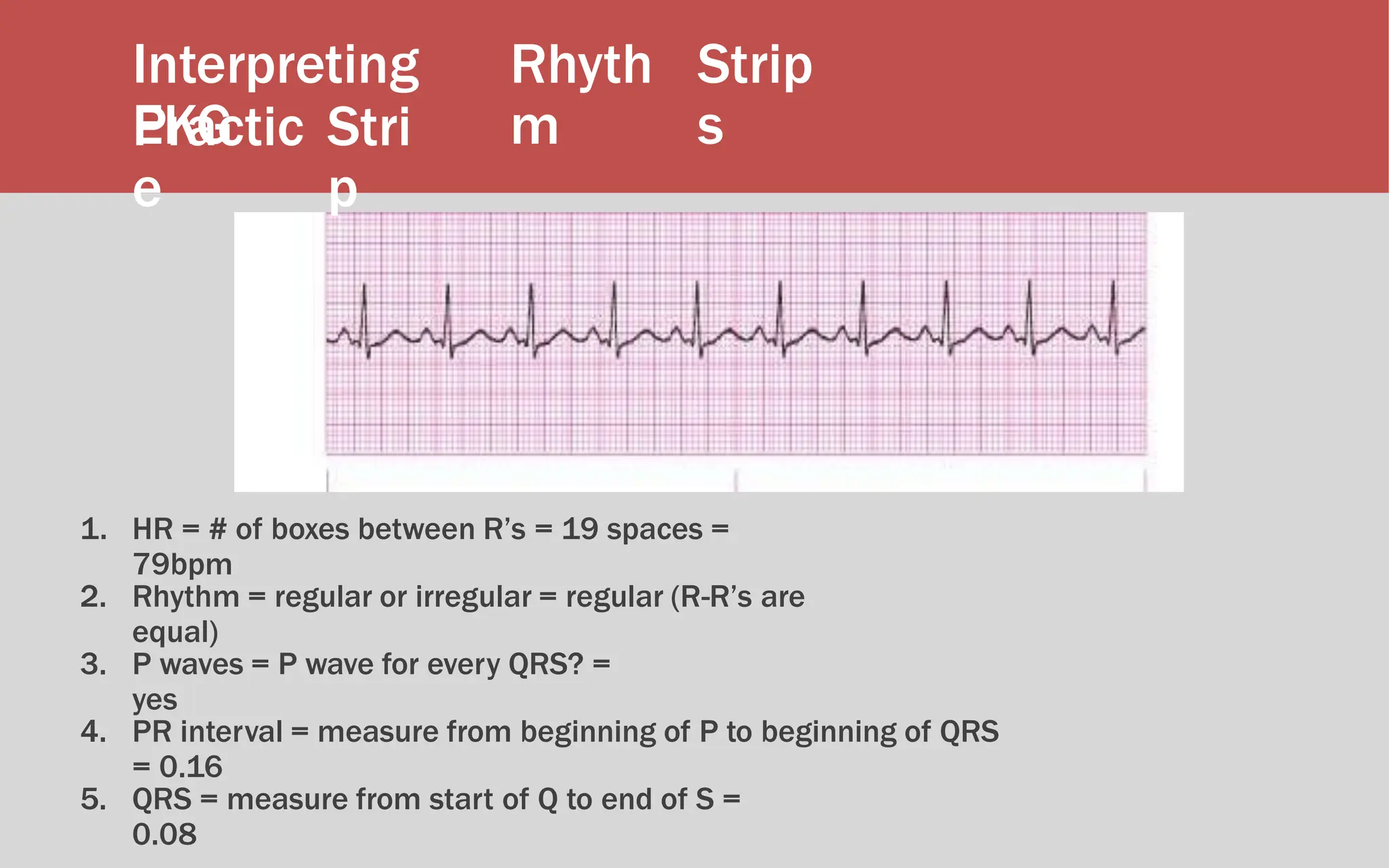 Interpreting
EKG
Rhyth
m
Strip
s
Practic
e
Stri
p
1. HR = # of boxes between R’s = 19 spaces =
79bpm
2. Rhythm = regular or irregular = regular (R-R’s are
equal)
3. P waves = P wave for every QRS? =
yes
4. PR interval = measure from beginning of P to beginning of QRS
= 0.16
5. QRS = measure from start of Q to end of S =
0.08
 
