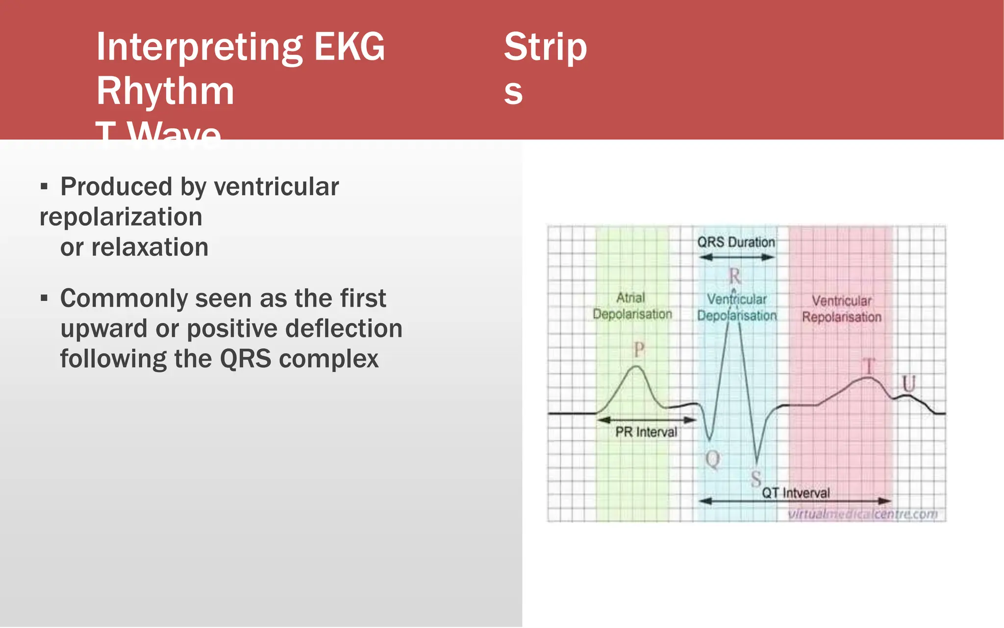 Interpreting EKG
Rhythm
T Wave
Strip
s
▪ Produced by ventricular
repolarization
or relaxation
▪ Commonly seen as the first
upward or positive deflection
following the QRS complex
 