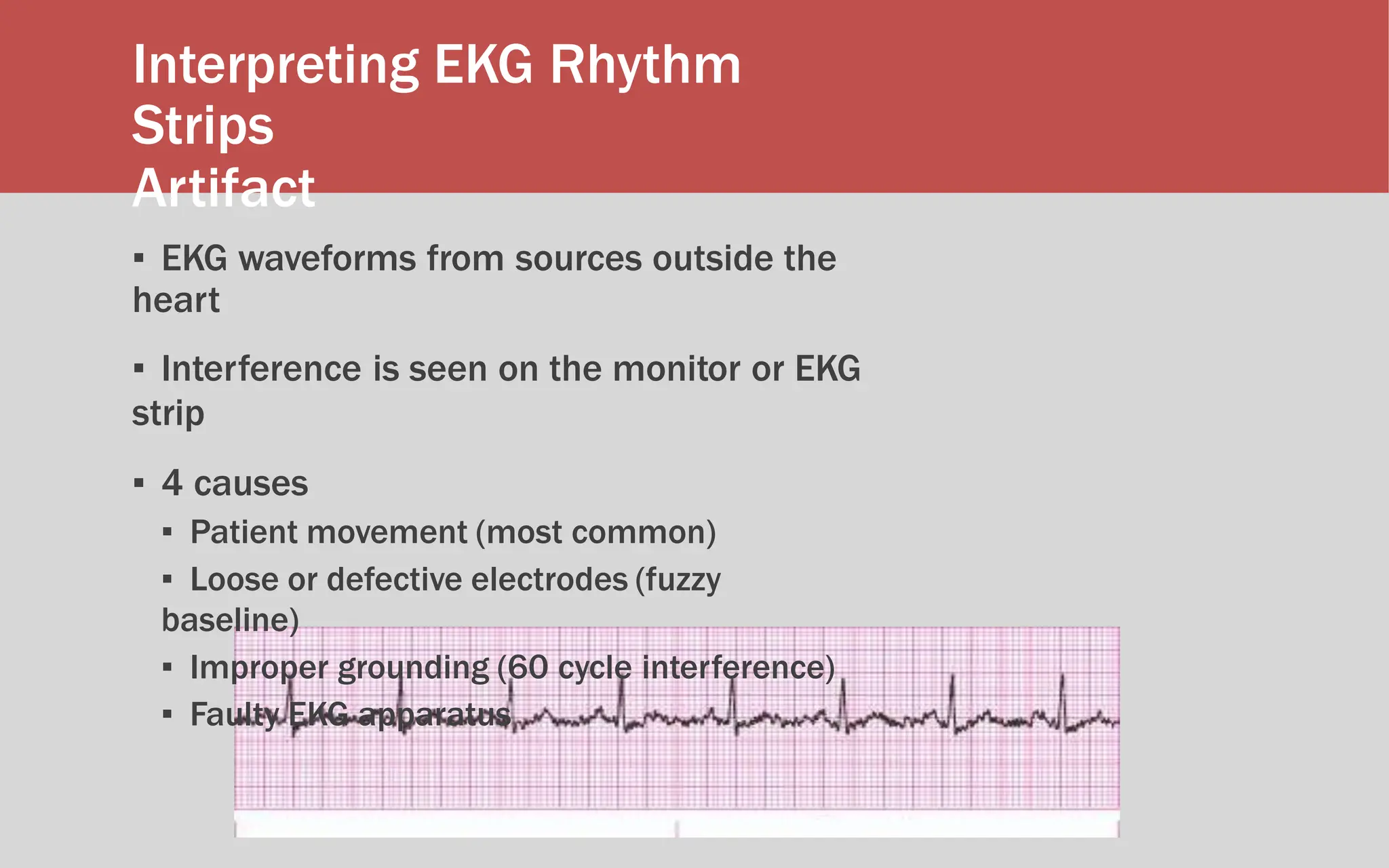 Interpreting EKG Rhythm
Strips
Artifact
▪ EKG waveforms from sources outside the
heart
▪ Interference is seen on the monitor or EKG
strip
▪ 4 causes
▪ Patient movement (most common)
▪ Loose or defective electrodes (fuzzy
baseline)
▪ Improper grounding (60 cycle interference)
▪ Faulty EKG apparatus
 