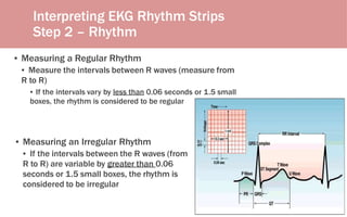 Regular Rythm Engineering Basic of ECG Referesher Course | PPTX