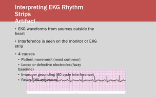 Basic of ECG Referesher Course | PPTX
