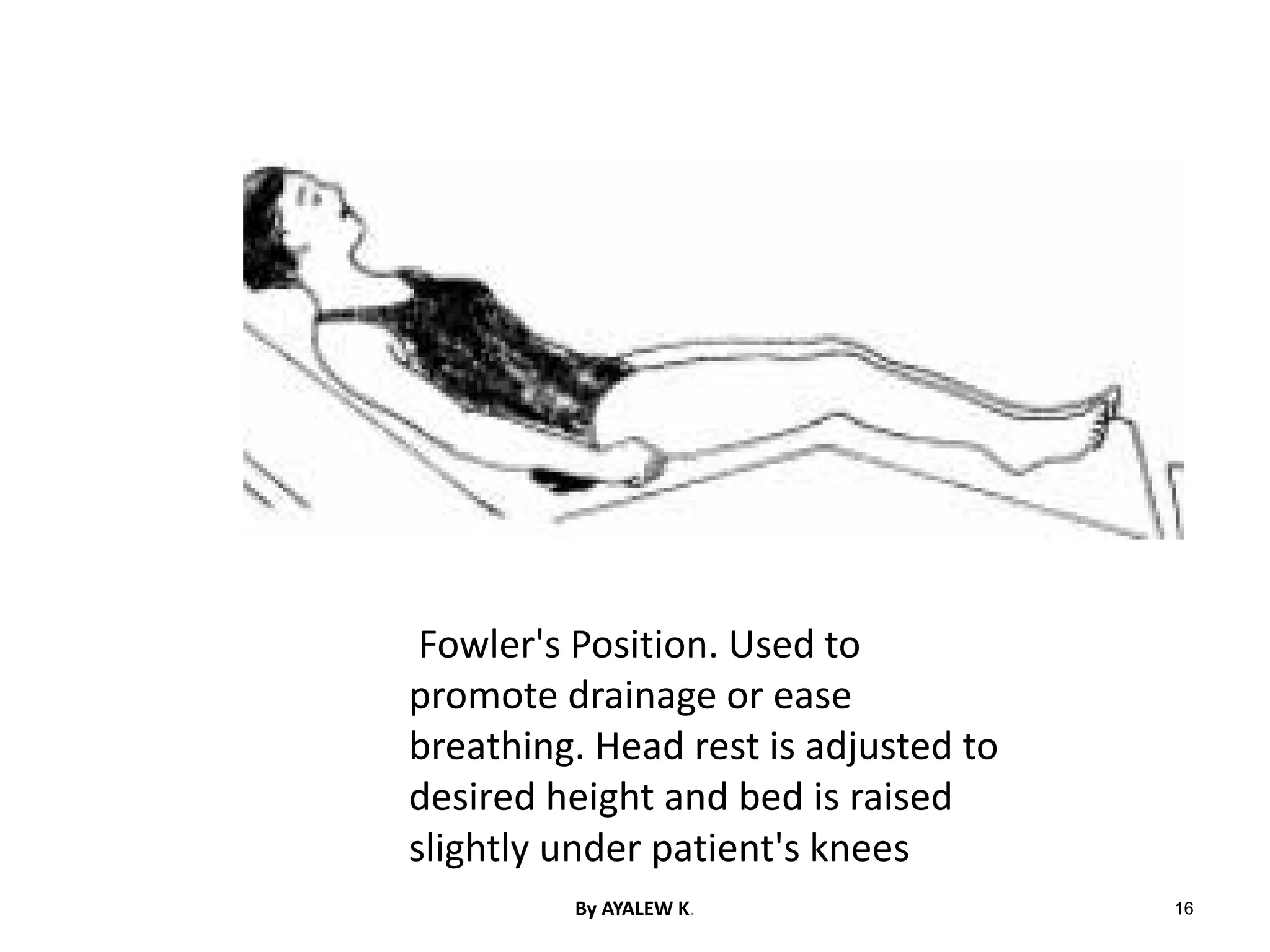Fowler's Position. Used to
promote drainage or ease
breathing. Head rest is adjusted to
desired height and bed is raised
slightly under patient's knees
16
By AYALEW K.
 
