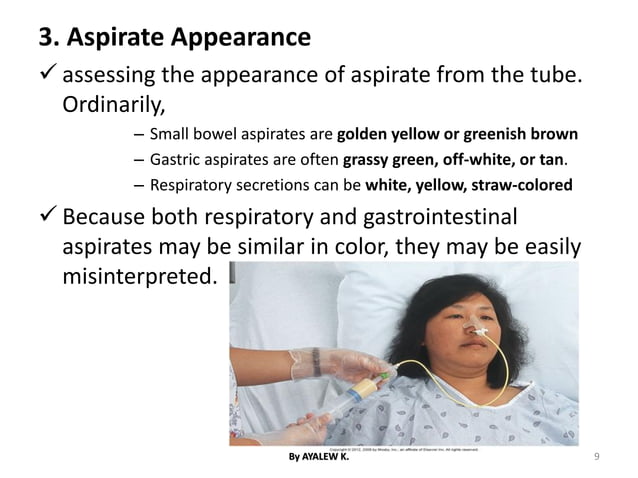 Ng Tube Injuries NASOGASTRIC TUBE INSERTION.pdf | First Aid | Injuries