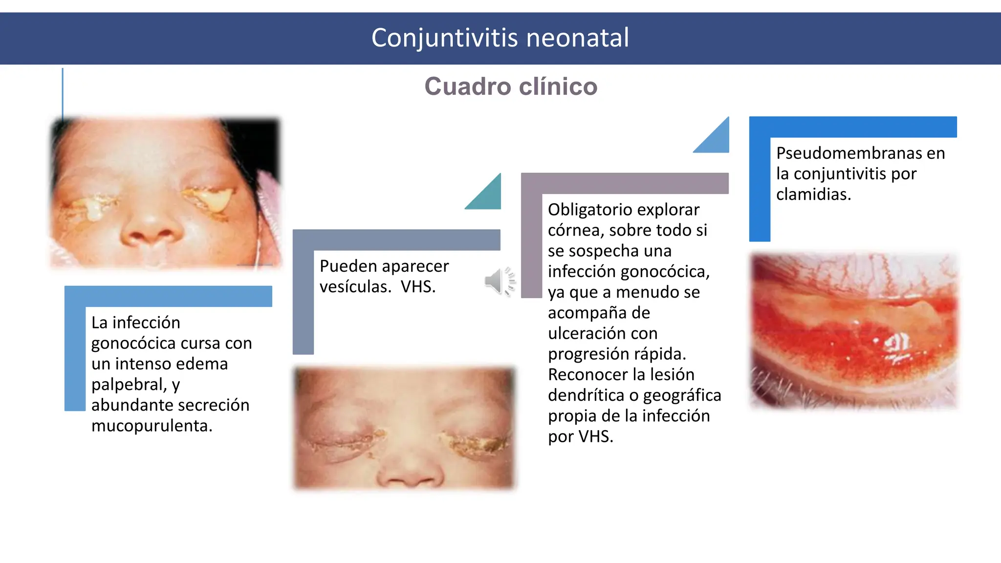2.- CONJUNTIVITIS CLAMIDIA.pptx--.......... | PPTX