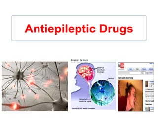 Antiepileptic Drugs
 