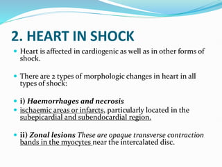 2. Shock.pptx